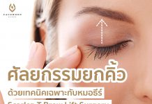เฟสบอดี้คลินิก มอบโปรโมชั่น 60% ศัลยกรรมยกคิ้วด้วยเทคนิคเฉพาะ Scarlez-T Brow Lift Surgery